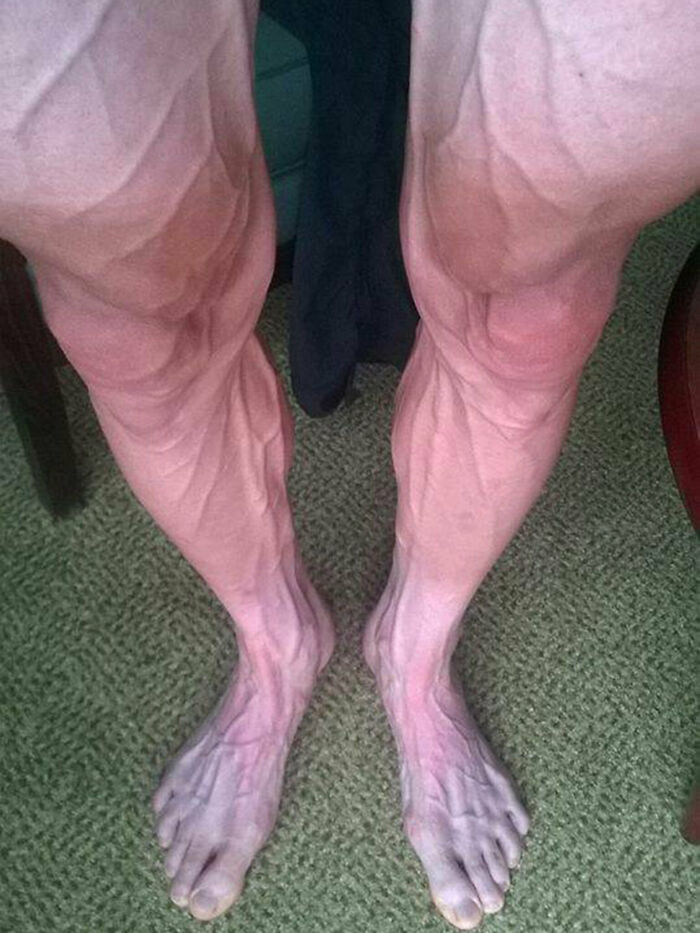 A Cyclist's Legs After A Stage Of The Tour De France