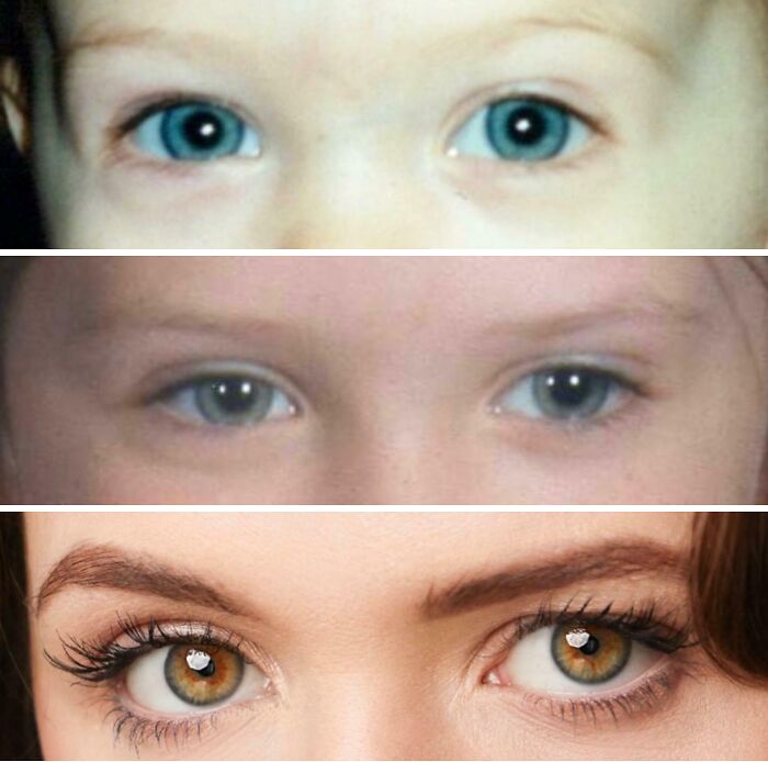 The Evolution Of My Eye Color (Age 2, 6, 17, 29)