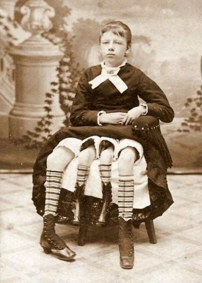 Victorian era photo of a young woman showcasing period fashion and an unusual multi-legged illusion pose.