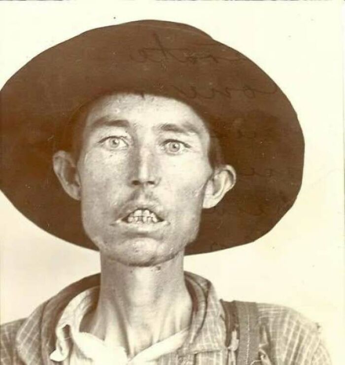 A sepia-toned historical photo shows a gaunt man in a hat with wide eyes, revealing a glimpse into past days.