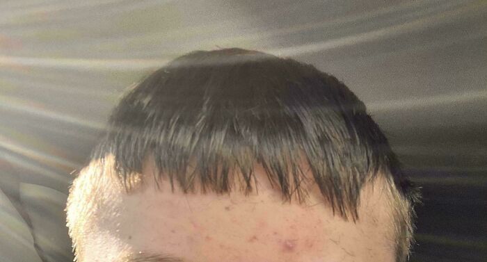 Close-up of a person's forehead with a very short, choppy, and unfortunate haircut with bangs.