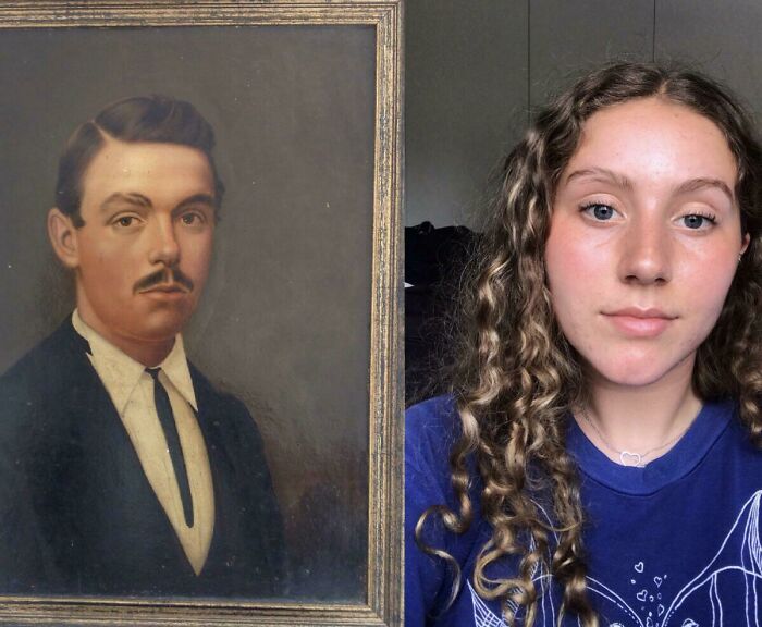 I Have A Hereditary Gap In My Eyebrow