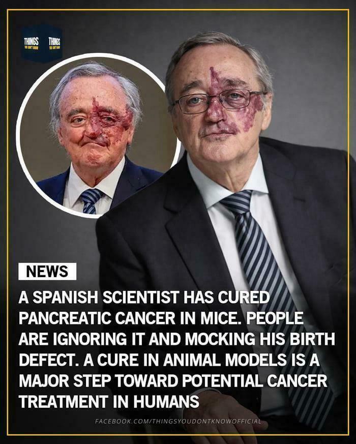 Fascinating pics of a Spanish scientist, who cured pancreatic cancer in mice, highlighting quick facts about his breakthrough and birth defect.