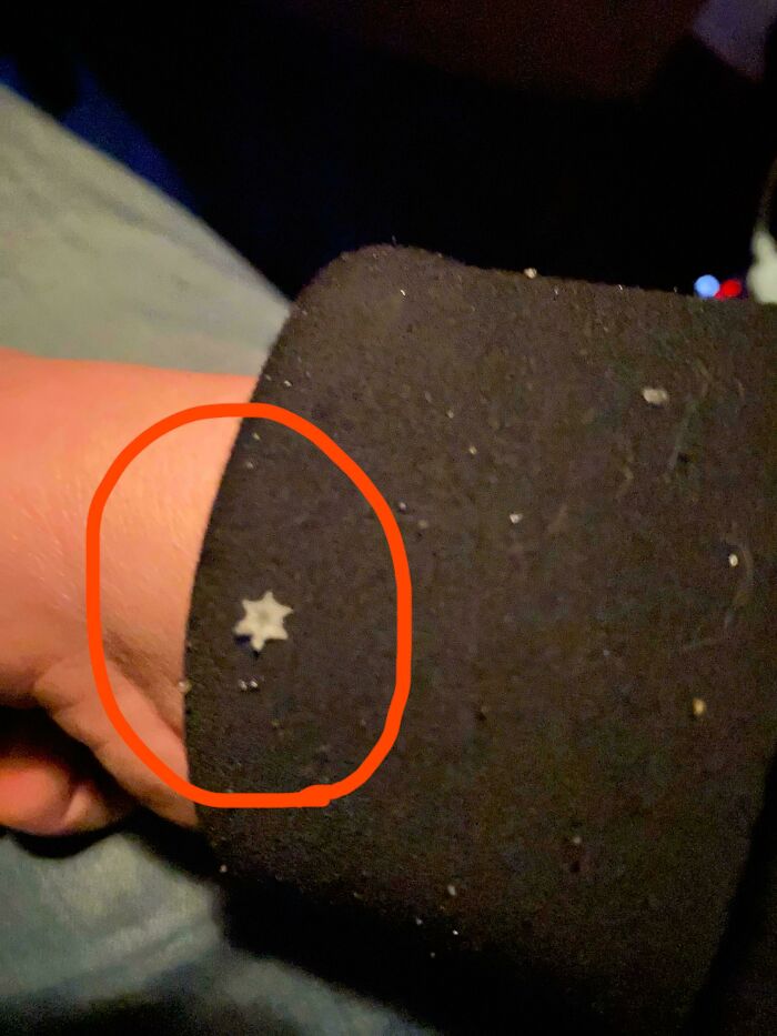 Tiny star-shaped object stuck on a black sleeve, a strange pic that people just had to take out of confusion.