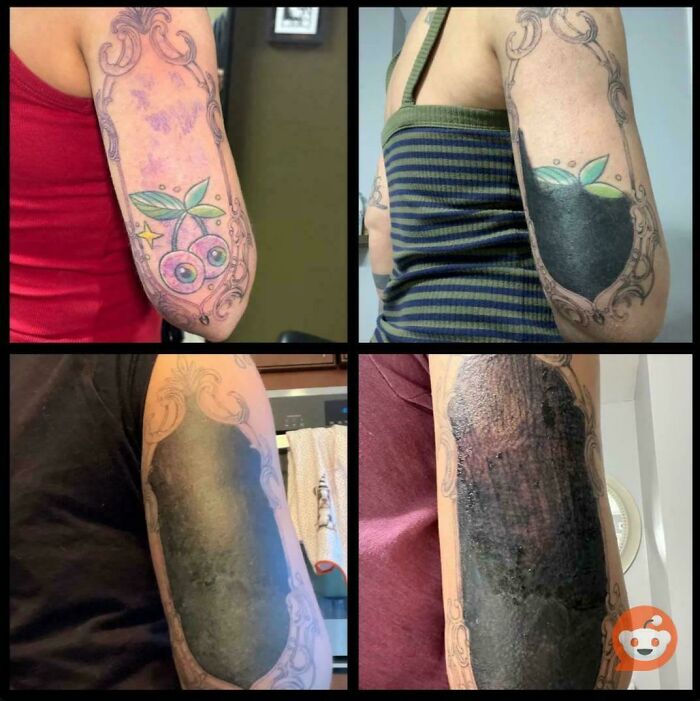 Four photos showing a tattoo cover-up process on an arm, illustrating truly awful tattoos being transformed or hidden.