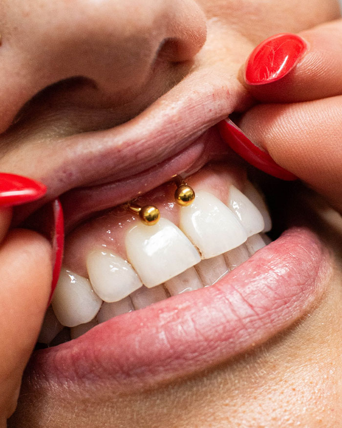 Close-up of dental piercings on upper front teeth with red-painted nails pulling up the lip, health experts alarm fans copying viral look.