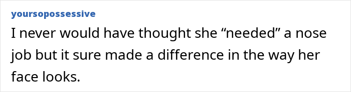 Kaley Cuoco open about realizing she'd gone too far with Botox during Big Bang Theory years in candid interview text.