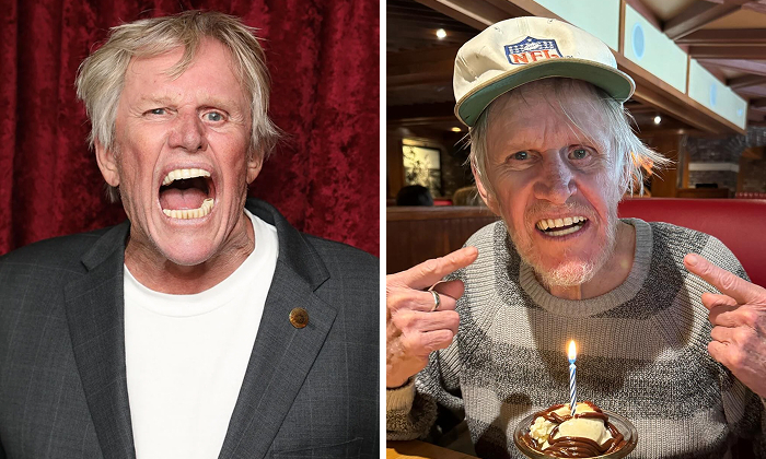 Gary Busey showing off his smile before and after celebrity dental implant makeover in casual and formal settings.