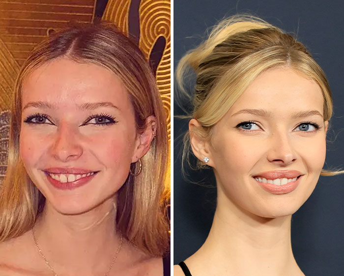 Apple Martin in two side-by-side portraits showing her before and after cosmetic procedures, smiling in both images