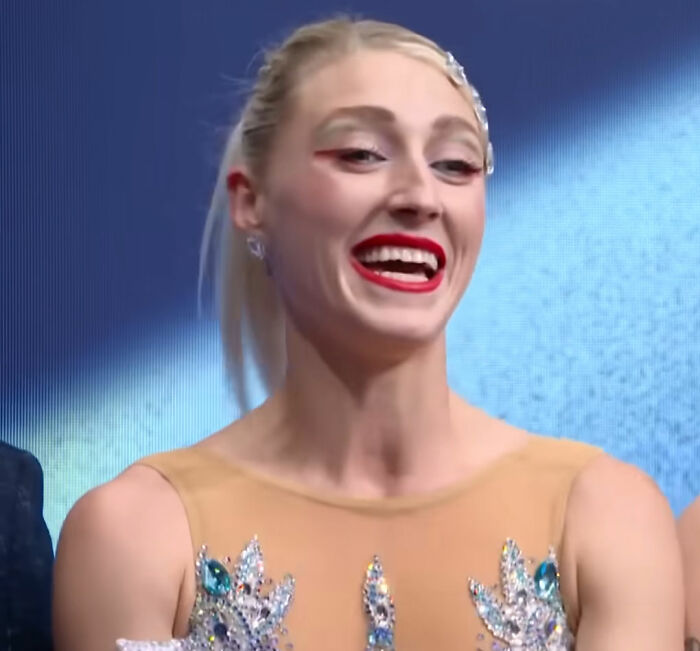 Olympic ice skater smiling during an interview after an incredible save from a wardrobe malfunction on ice.