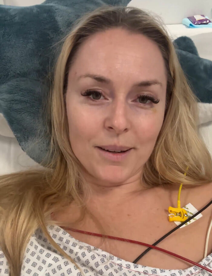 Olympian Lindsey Vonn in hospital bed with medical monitoring after horrific crash and major update on her leg injury.