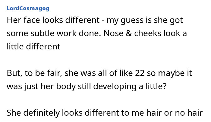 Kaley Cuoco Reveals Moment On 'Big Bang Theory' She Realized She'd Gone Too Far With Botox