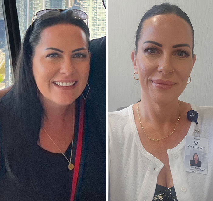 Before and after photos showing dramatic facial changes during an Ozempic journey with visible weight loss effects.