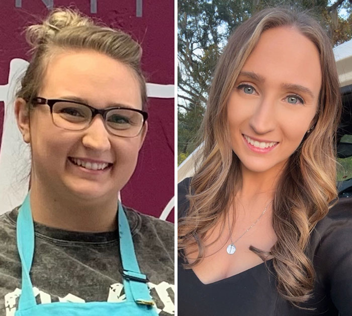 Before and after photos showing dramatic facial changes from the Ozempic face transformation journey.