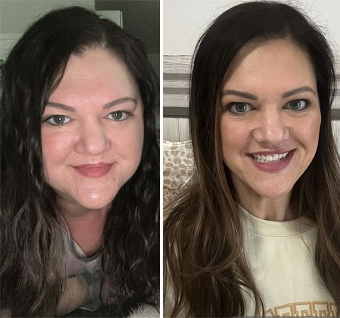 Before and after photos showing dramatic facial changes during an Ozempic weight loss journey in two women.