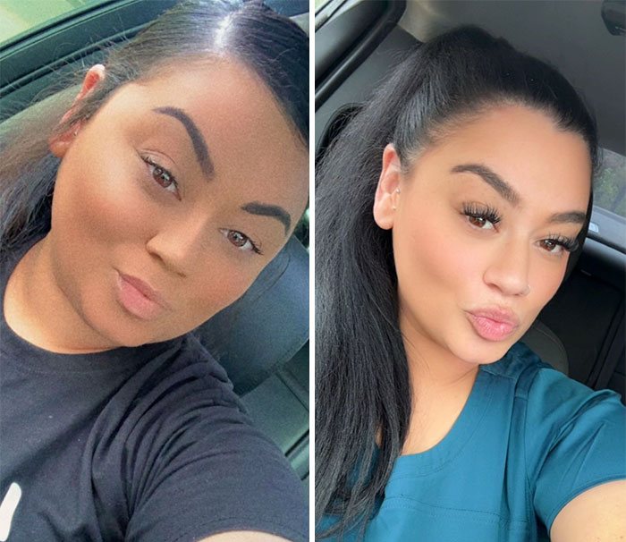 Before and after images showing dramatic facial changes during an Ozempic face transformation journey.