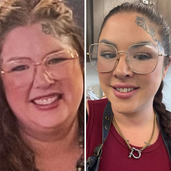 Before and after portraits showing dramatic facial changes from the Ozempic face weight loss journey.