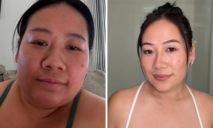 Before and after photos showing dramatic facial changes during an Ozempic journey with noticeable weight loss and skin improvement.