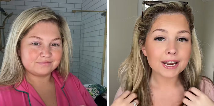 Before and after photos of a woman showing dramatic facial changes during her Ozempic journey.