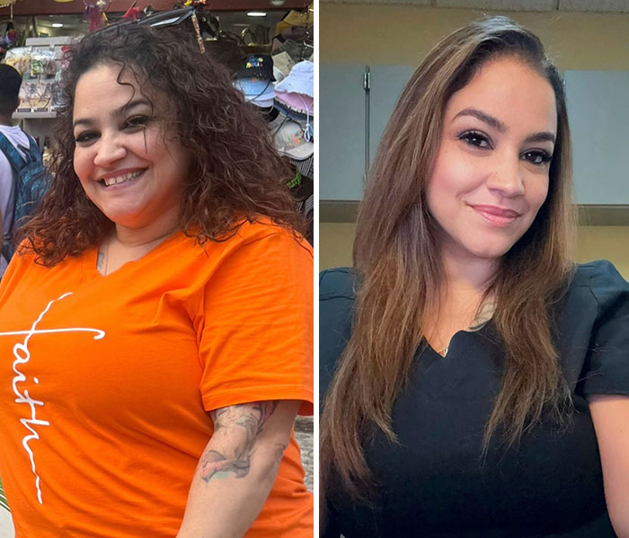 Before and after photos showing dramatic facial changes from the Ozempic journey in a woman smiling confidently.