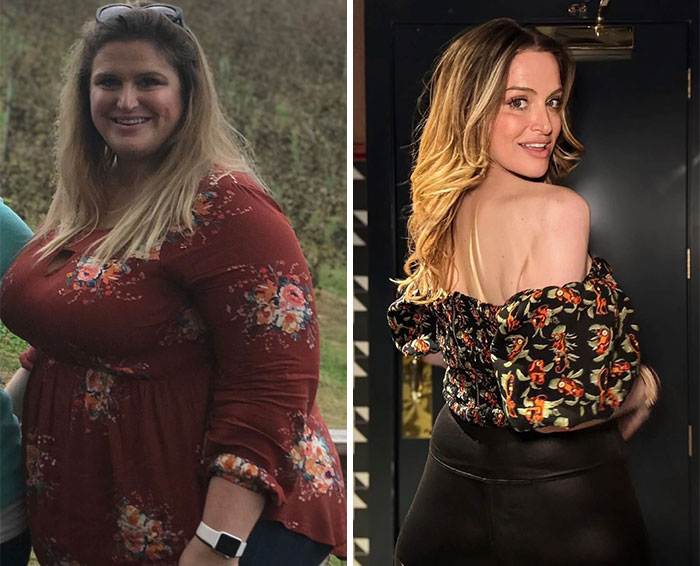 Before and after photos showing dramatic facial changes and weight loss during an Ozempic face transformation journey.