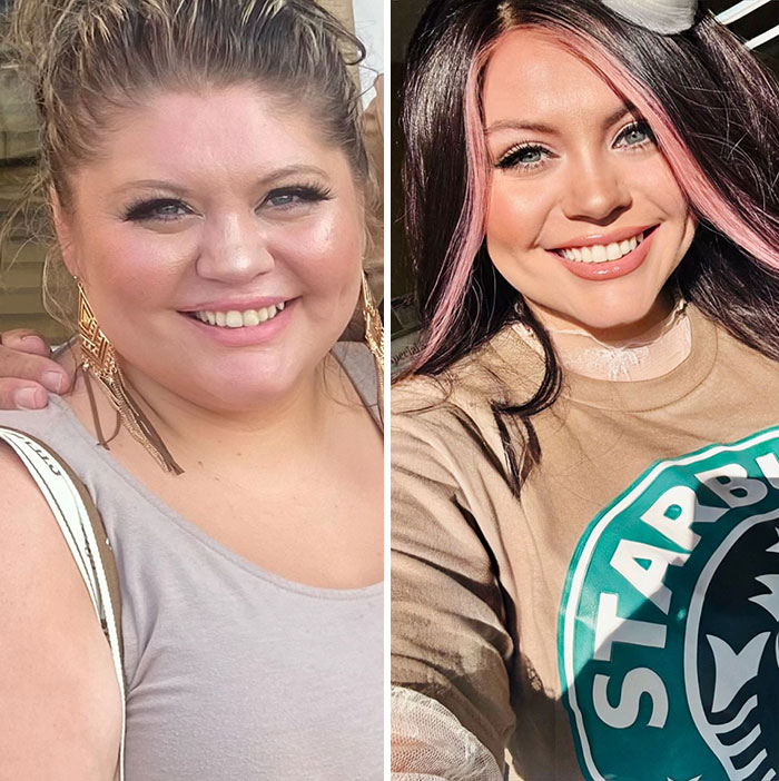 Before and after photos showing dramatic facial changes from the Ozempic face weight loss journey.