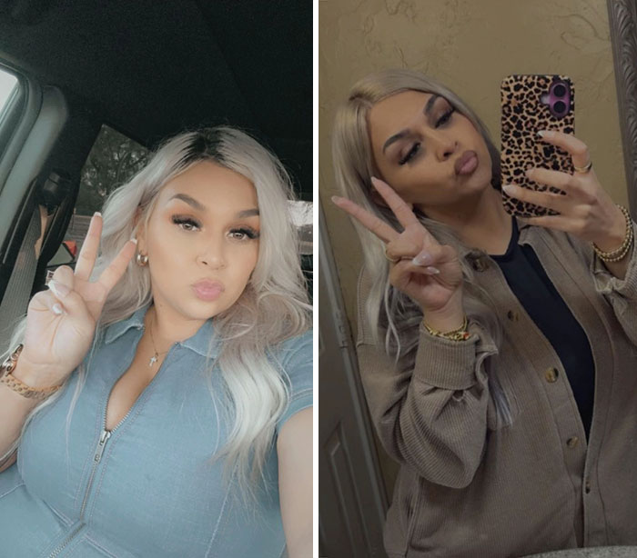Side-by-side selfies of a woman showing dramatic facial changes from her Ozempic face journey with peace signs and pursed lips.