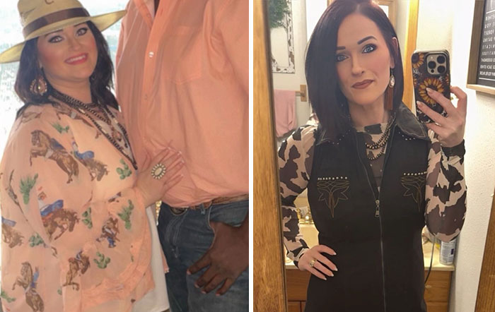 Before and after photos of a woman showing dramatic facial changes during her Ozempic face journey.