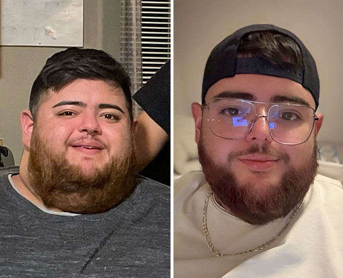 Before and after photos of a man showing dramatic facial changes during his Ozempic journey.