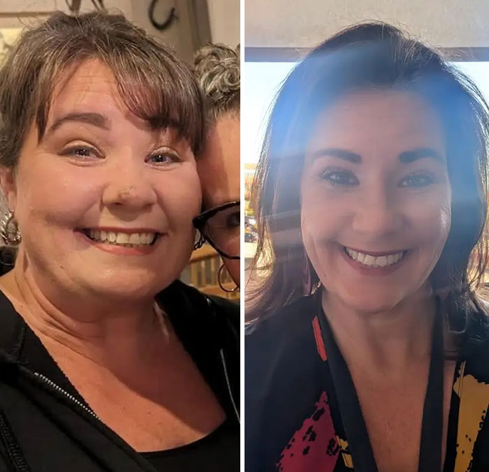 Before and after photos showing dramatic facial changes from the Ozempic journey, highlighting Ozempic face transformation.