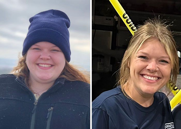 Before and after photos of a woman showing dramatic facial changes during her Ozempic face weight loss journey.