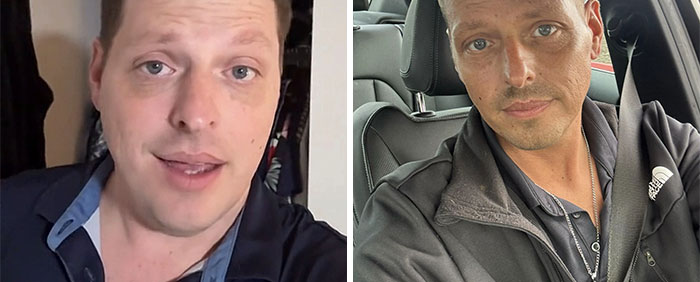 Before and after photos of a man showing dramatic facial changes from his Ozempic journey.