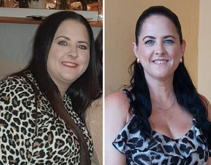 Before and after portraits of a woman showing dramatic facial changes during her Ozempic journey with noticeable weight loss effects.