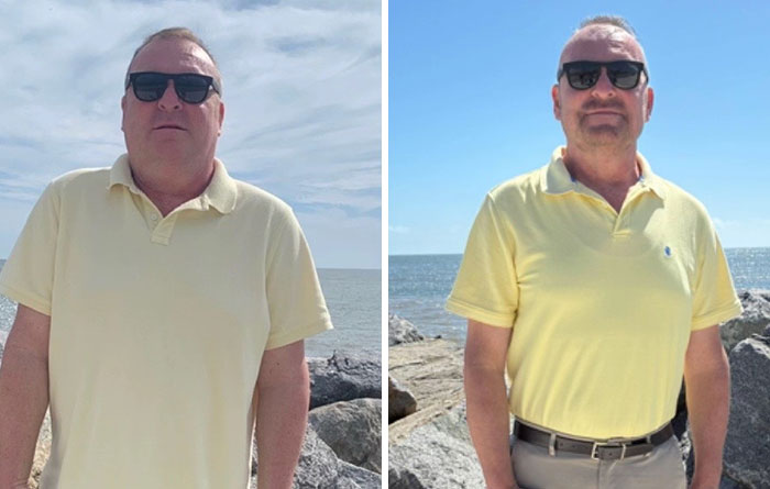 Man wearing sunglasses and a yellow polo shirt showing dramatic facial changes after Ozempic journey by the sea.