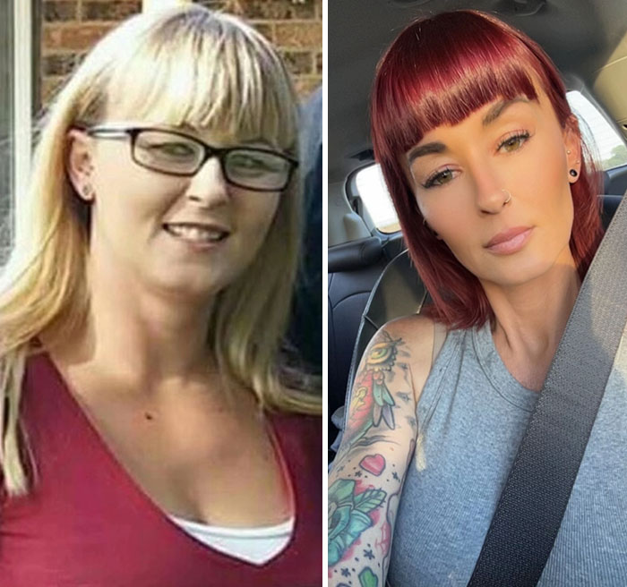 Before and after photos showing dramatic facial changes from the Ozempic journey featuring Ozempic face transformation.