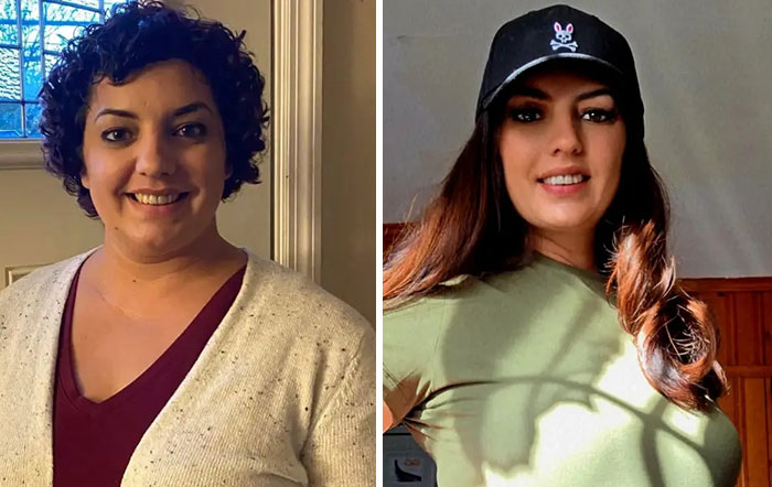 Before and after photos of a woman showing dramatic facial changes during her Ozempic journey and Ozempic face transformation.