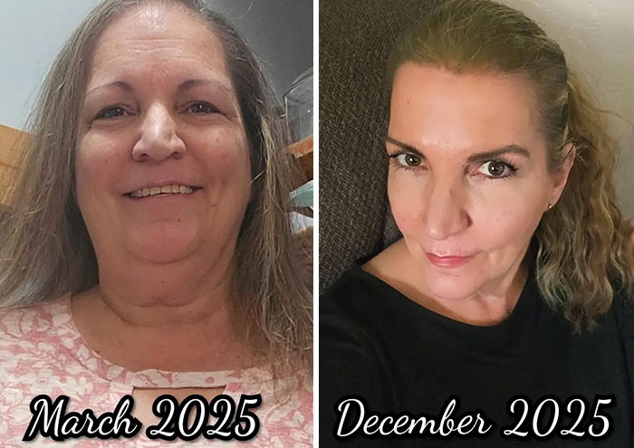 Before and after photos showing dramatic facial changes from an Ozempic journey between March and December 2025.