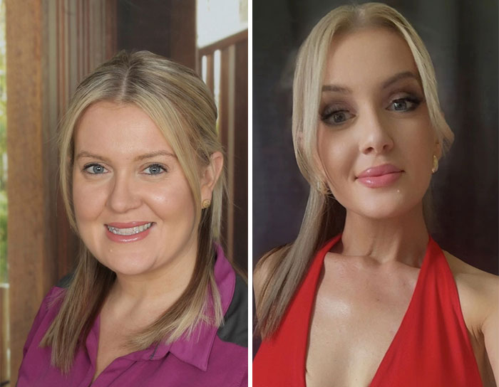 Before and after portraits showing dramatic facial changes from the Ozempic face transformation journey.