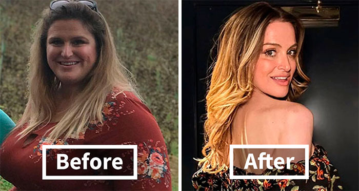 “I’ll Take Ozempic Face”: 77 People Share The Dramatic Facial Changes That Came With Their Ozempic Journey