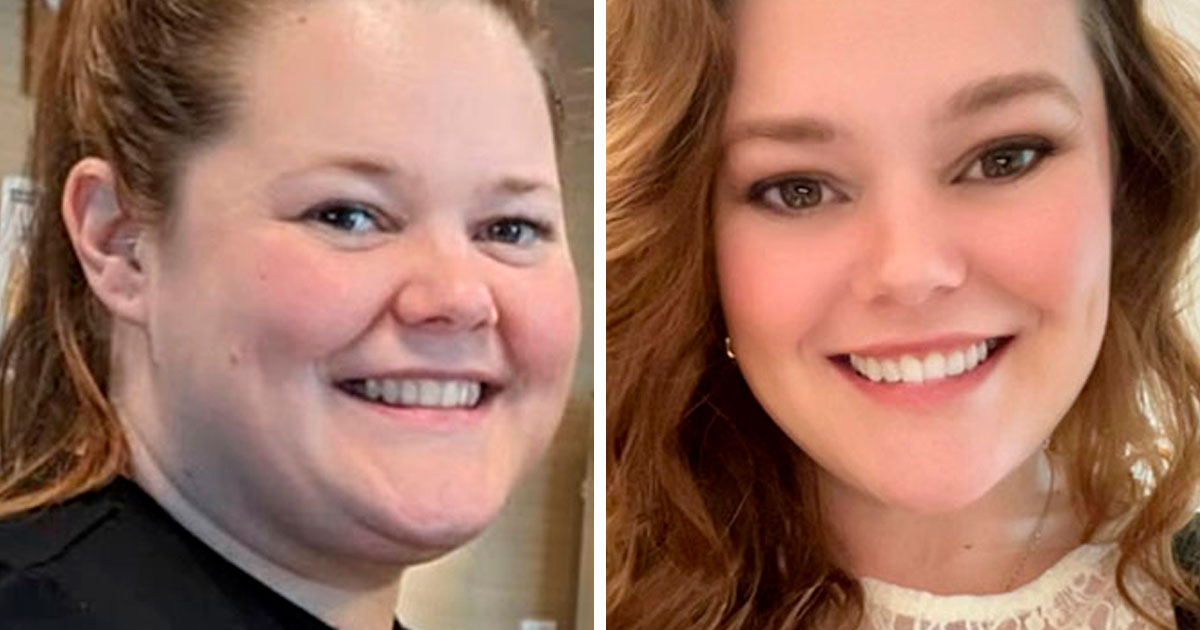 33 Personas comparten los drásticos cambios faciales que experimentaron durante su tratamiento con Ozempic