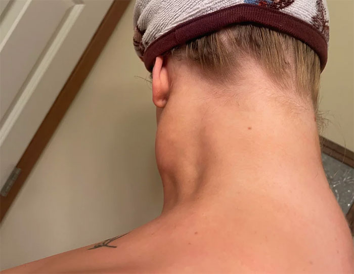 Close-up of a person's neck showing an unusual muscle bump, a weirdly hilarious image to improve your feed and mood.