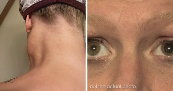 “Nearly Cost Me My Life”: 82 Body Warning Signs You Shouldn’t Brush Off