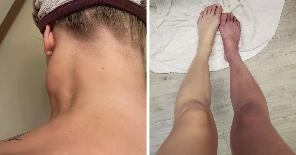 82 Signs Our Bodies Give Us That Can Actually Be Silent Cries For Help - Bored Panda