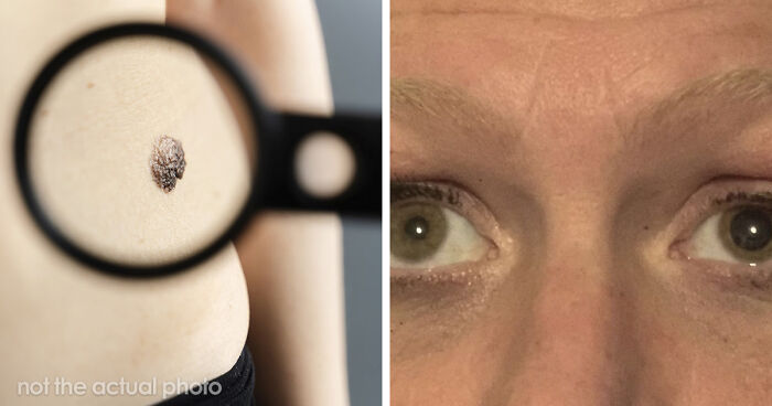 “Nearly Cost Me My Life”: 82 Body Warning Signs You Shouldn’t Brush Off