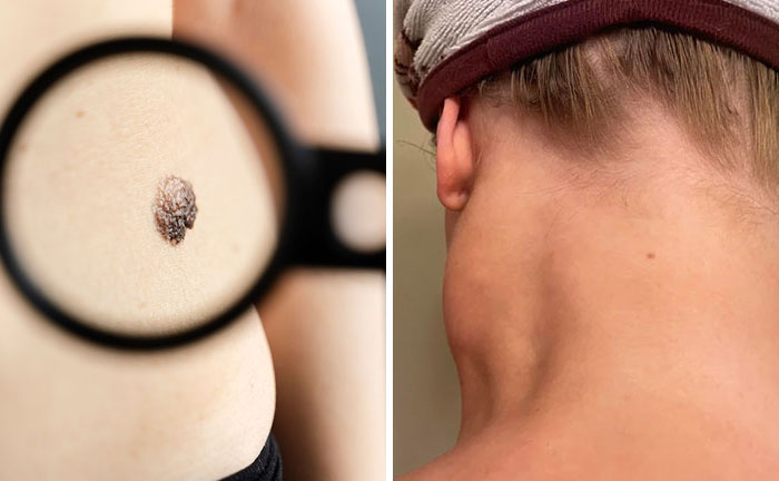 “Nearly Cost Me My Life”: 82 Body Warning Signs You Shouldn’t Brush Off