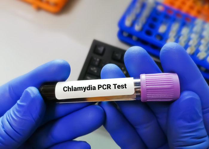 Gloved hands holding a Chlamydia PCR test tube in a lab setting, related to boyfriend cheating and relationship concerns.