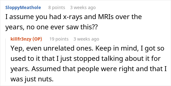 Screenshot of an online forum discussion about a man spending 35 years with throat pain before solving his medical mystery.