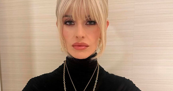 “I Hope To God This Is Photoshopped”: Photo Of Kelly Osbourne’s Hand Sparks Fan Concern