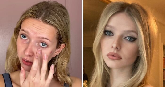 Gwyneth Paltrow's 'Nepo Baby' Apple Martin Reveals All The Cosmetic Procedures She's Had