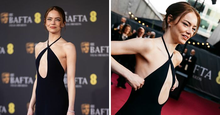 “She Looks Cadaverous”: Emma Stone’s Appearance At The 2026 BAFTAs Sparks Major Concerns